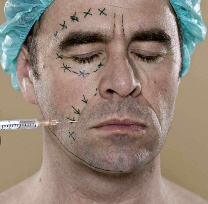 Plastische Chirurgie Für Männer. Botox, Facelifts & Mehr Erklärt